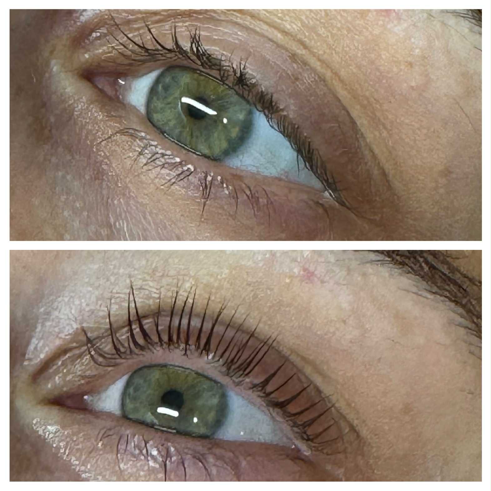 Behandeling wimpers en wb